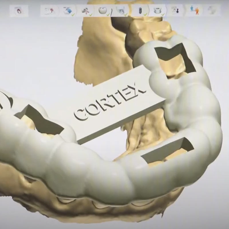 digital implant Work Flow